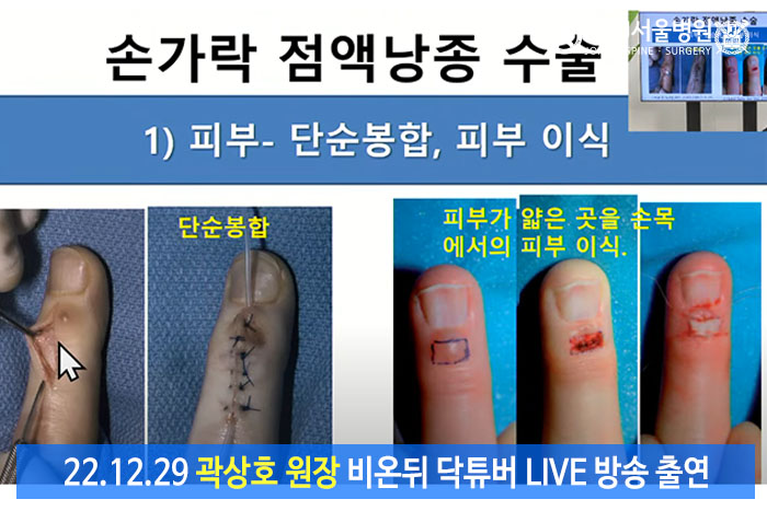 19a2b29f897fe7c83b9a5033a0b85ae4_1672362072_9554.jpg 19a2b29f897fe7c83b9a5033a0b85ae4_1672362072_9554.jpg